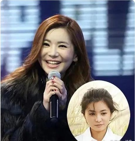 张瑞希整容前后：整容前的样子令人瞠目结舌