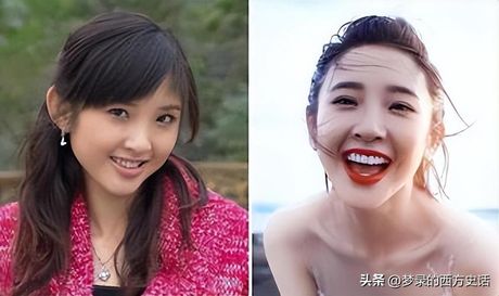 唐艺昕整容，唐艺昕整容后的惊人形象电视话题热炒中！