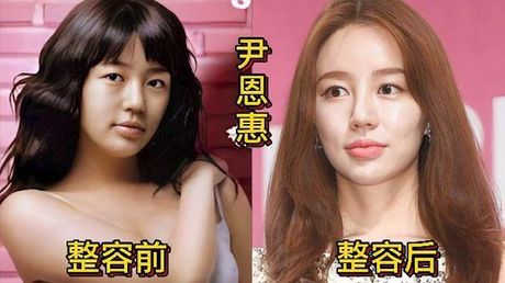 韩国明星整容失败：美内陷毁容无期？
